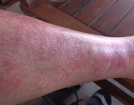 insektbid africa tours